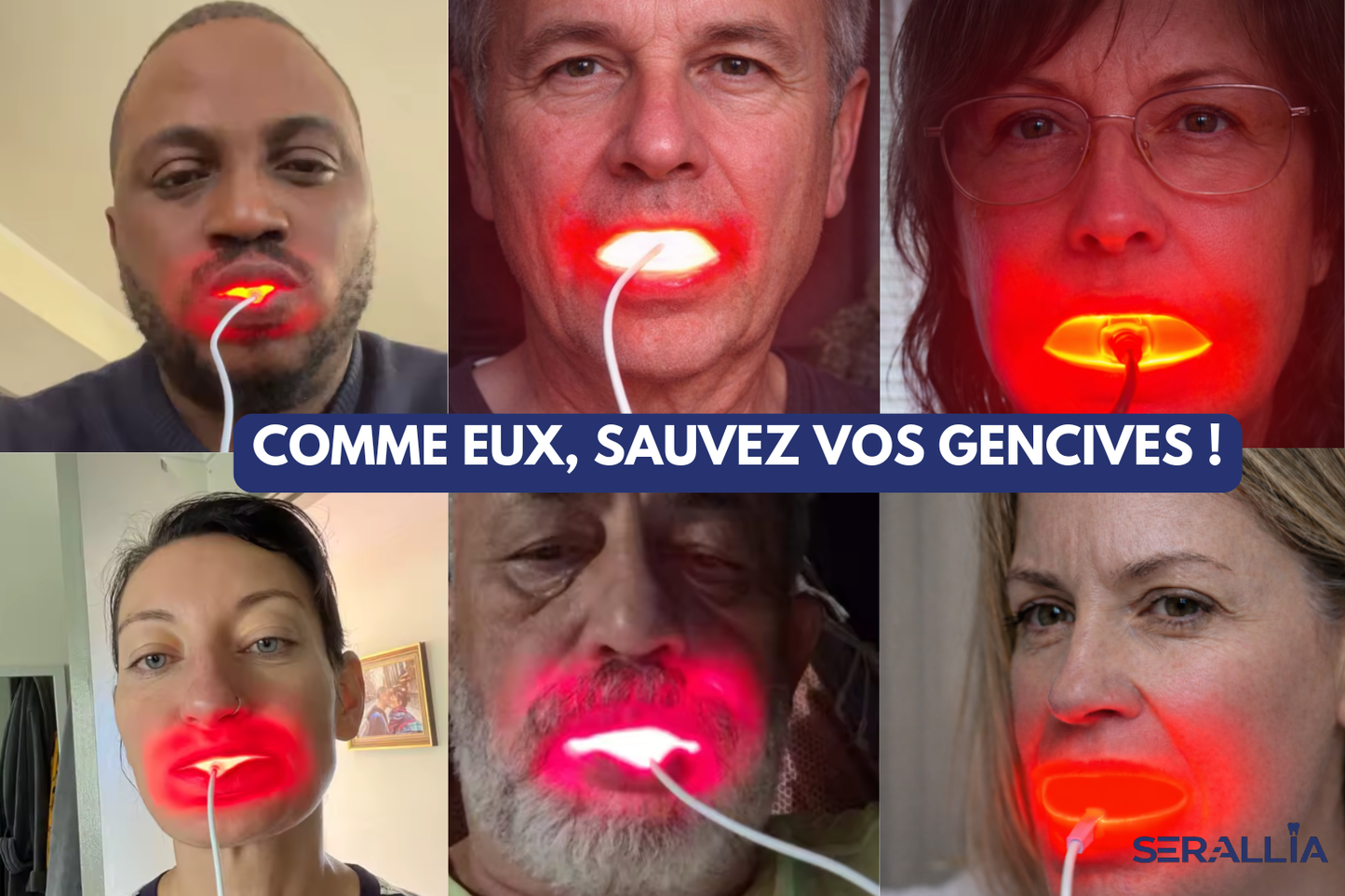 Protocole Gingival SERALLIA™